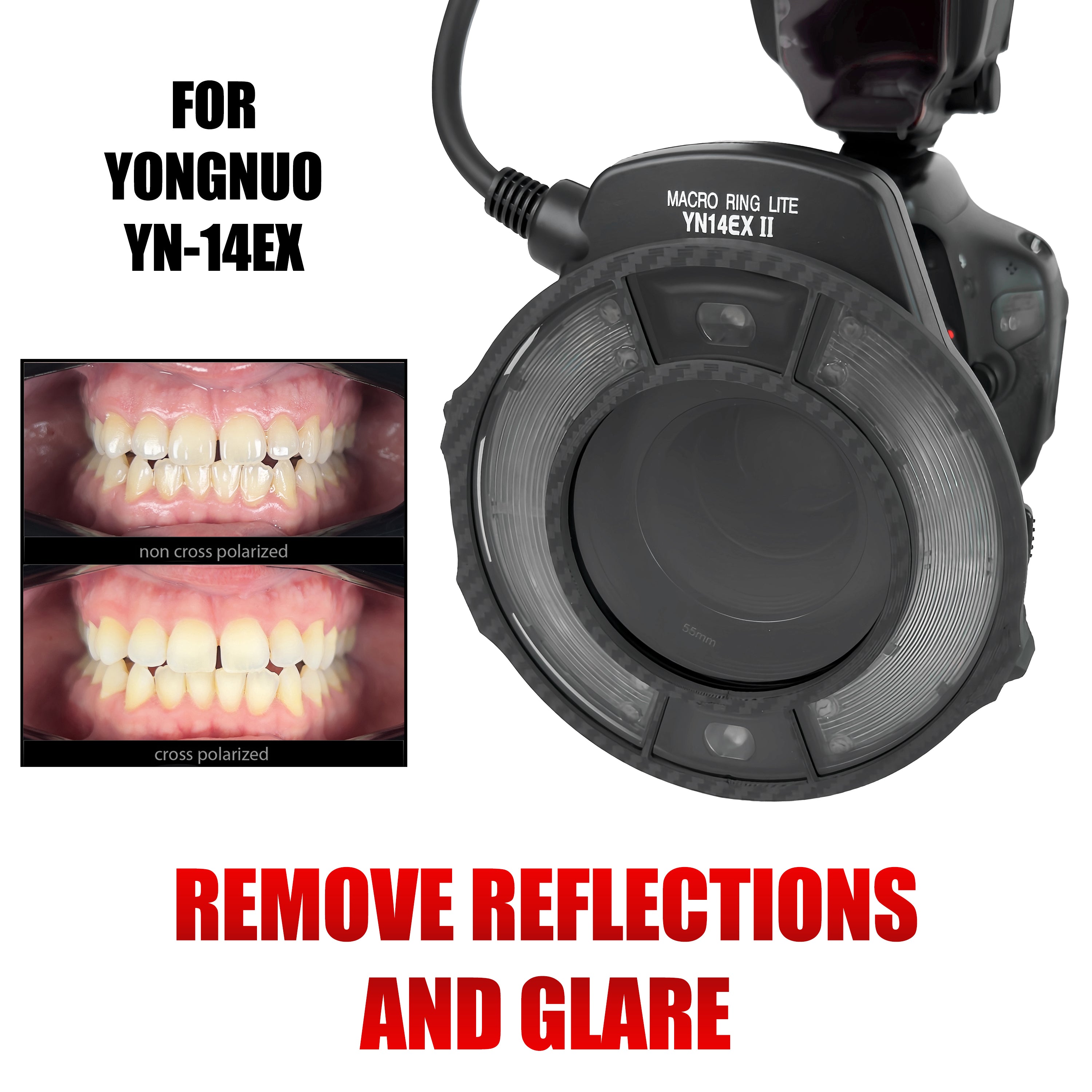 Cross Polarization Set For YONGNUO YN-14 – Dental-photo
