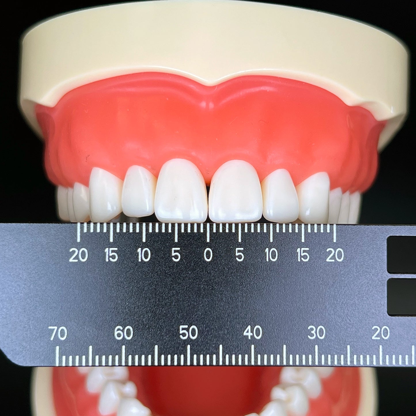 Dental Precision Measuring Ruler