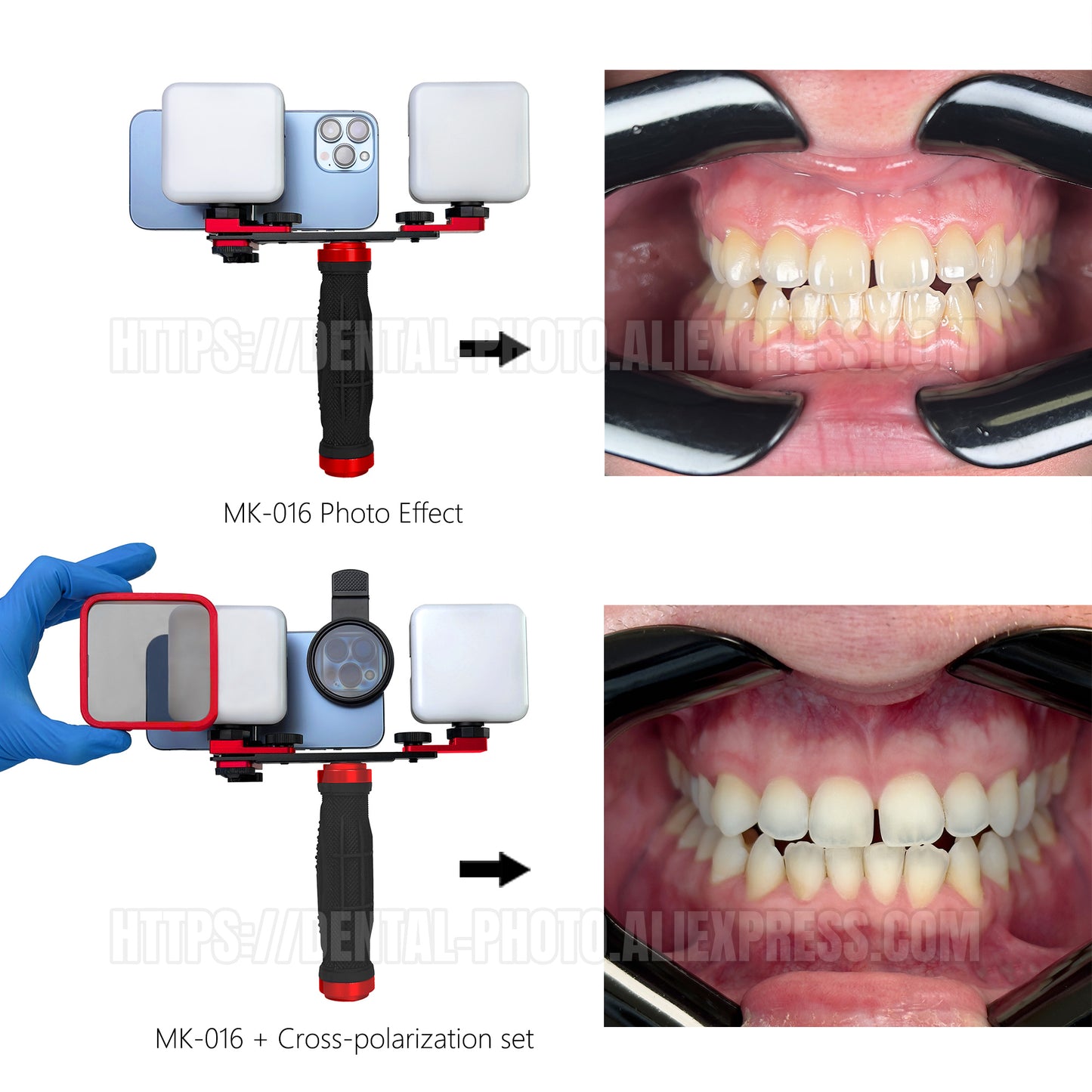 MK-016 ベーシック