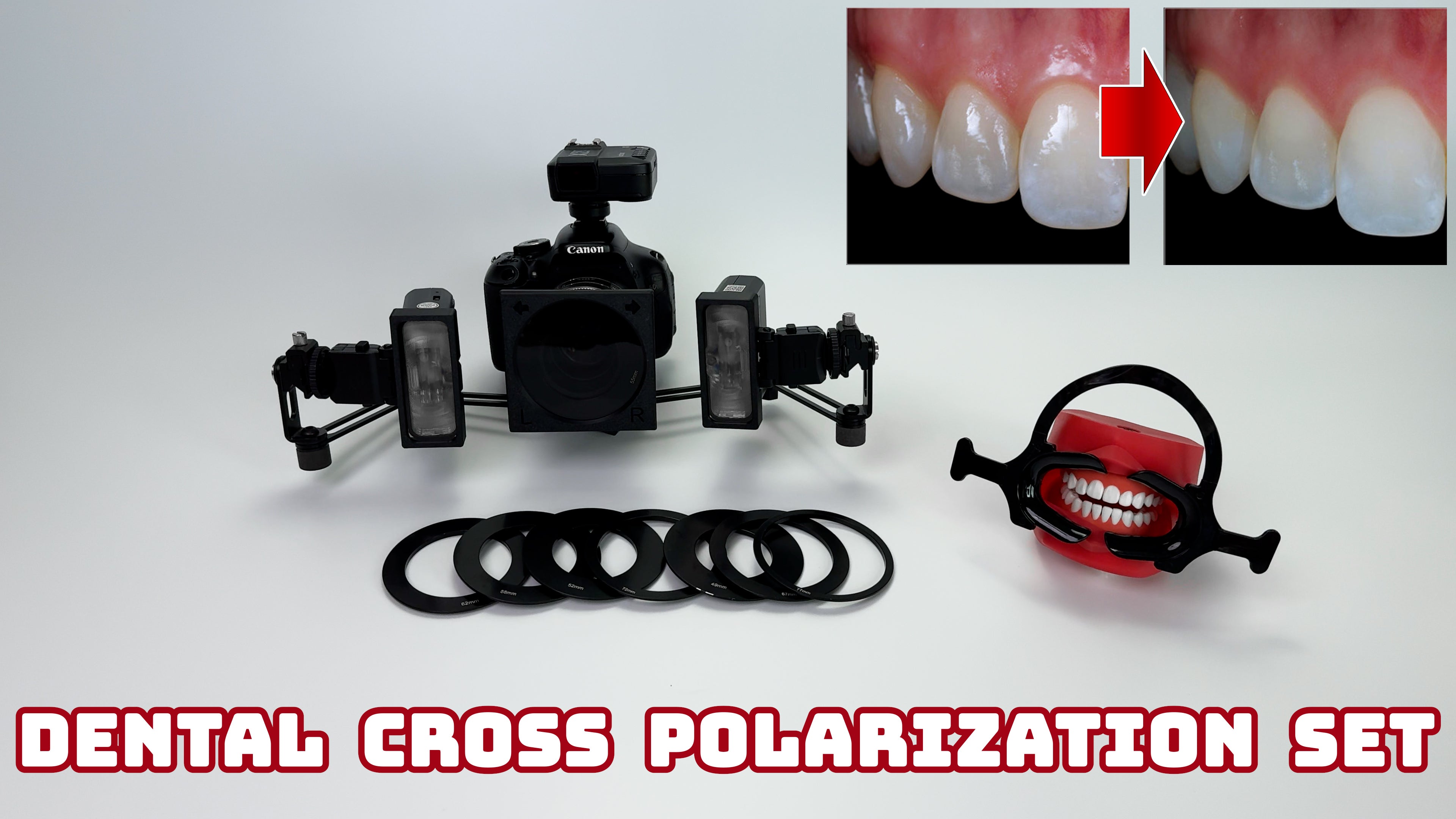 動画を読み込む: 